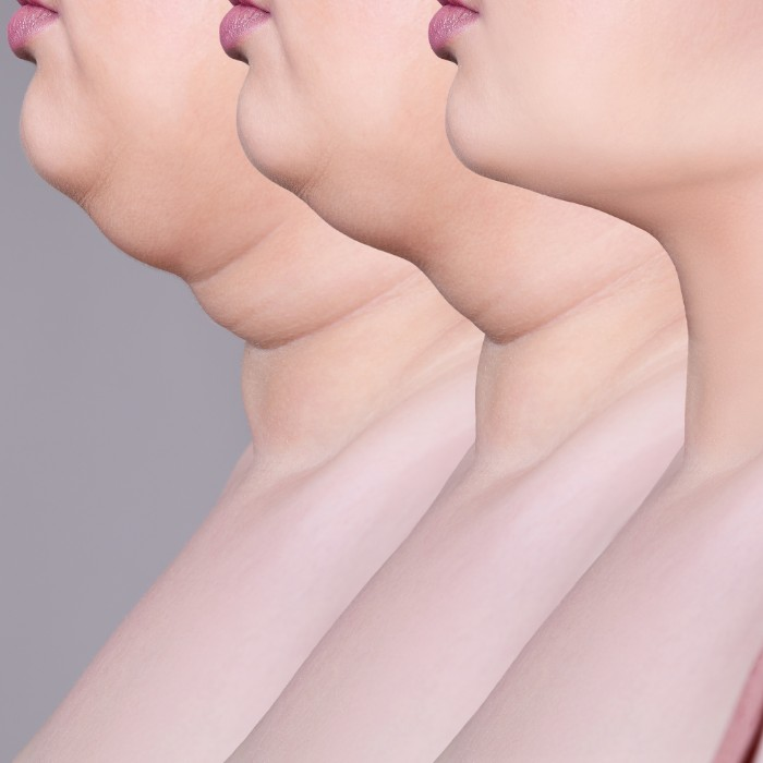 3 women standing in a line with a big double chin, a smaller double chin and no double chin.